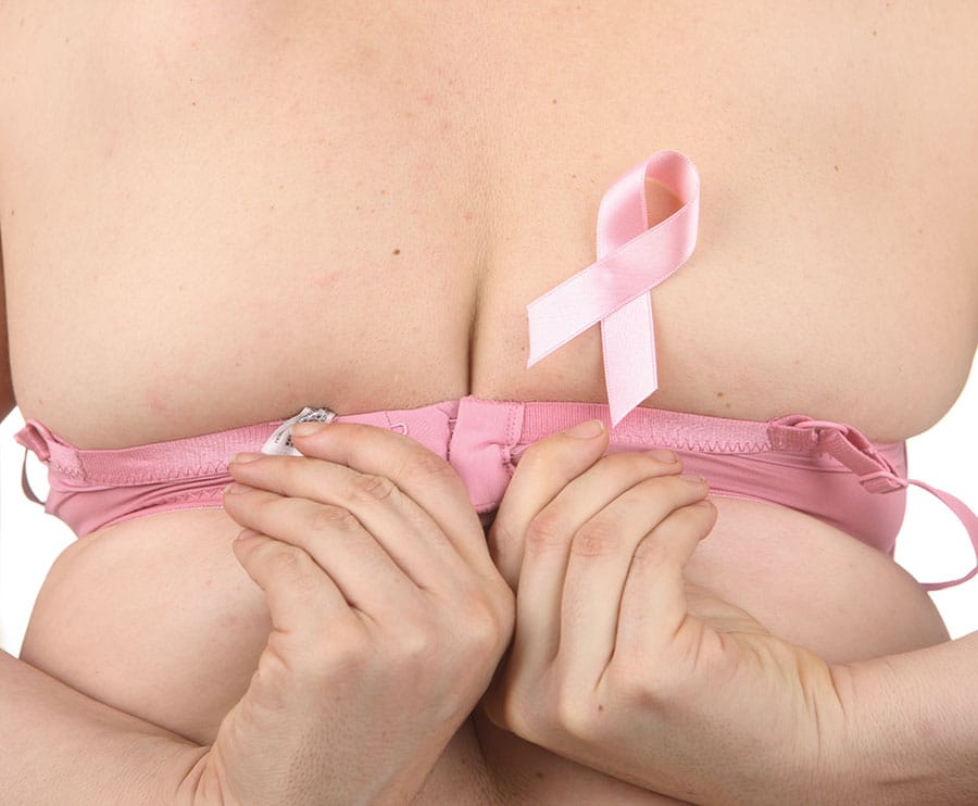 Obesità 18 Obesità e aumento del rischio di cancro